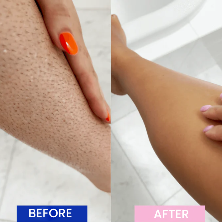 Mae Pro™ | Pijnloze Laser Ontharing-Epilator